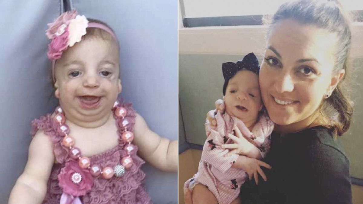 Mother of a little girl with rare condition says ‘her heart breaks’ when people do this to her daughter