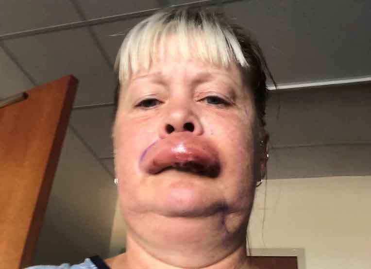 When doctors told this woman why her lip is swollen, ‘she screamed in fear and prayed she won’t die’!