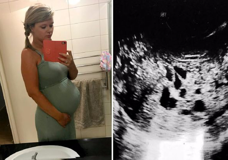 Doctors screamed in disbelief when woman gave birth in the toilet after her ‘unborn baby turned out to be something else’!