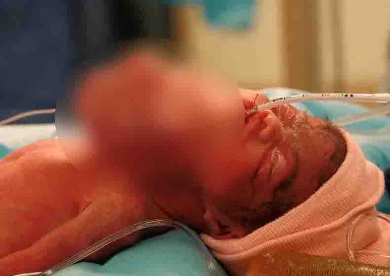 Doctors saw something coming out of the baby’s neck; ‘when they find out what it was, it left them speechless’! 