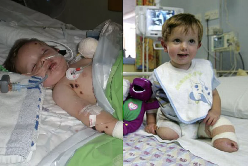 Boy lost both his legs and struggled to get around, ‘then this happened’!