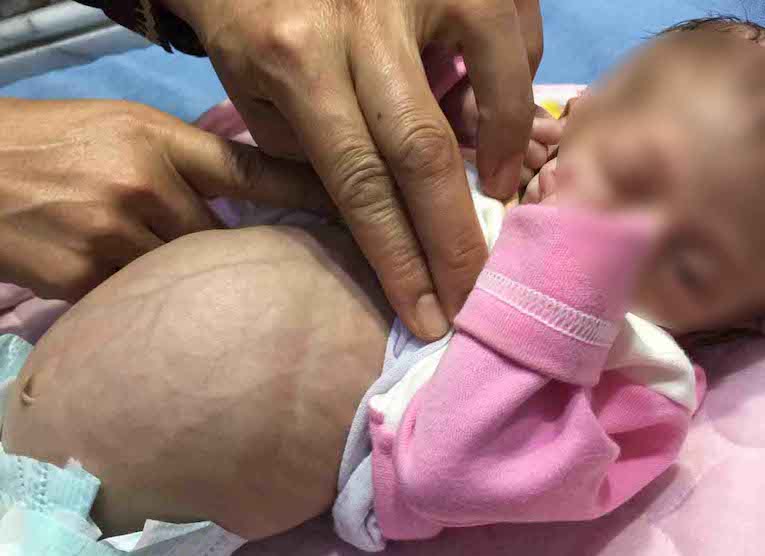 Something creepy growing inside this newborn baby ‘stumped doctors after discovering its nature’!
