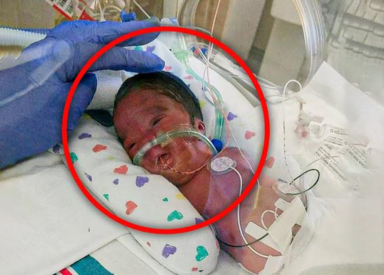 Mom abandoned her baby in the hospital, ‘things got much worse when they lift his blanket’!