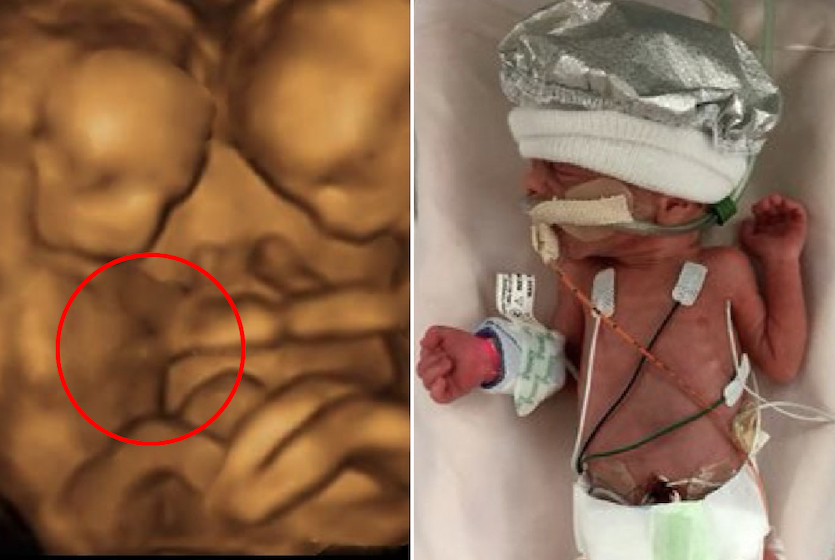 Unborn girl sent signals from the womb of her mother and ‘doctors discovered something astonishing’!