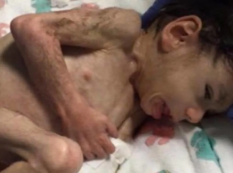 This boy was neglected and was about to die, ‘then a miracle change his life’!