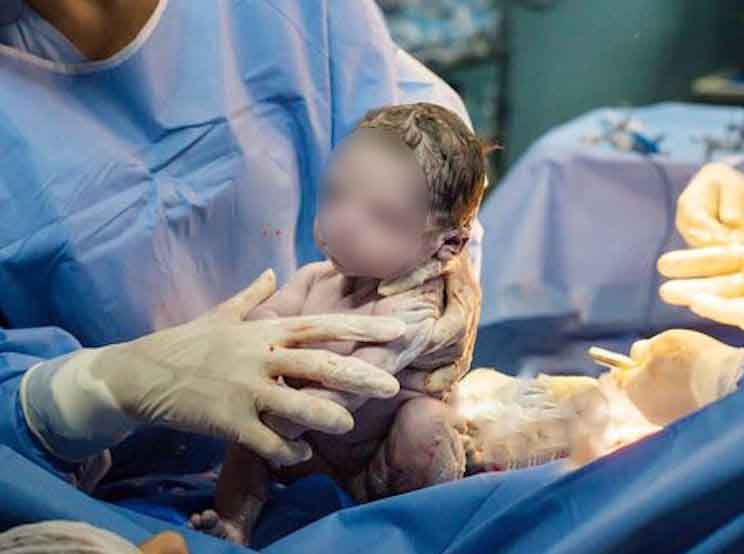 Doctors and parents couldn’t believe ‘what this newborn did seconds after she was born’!