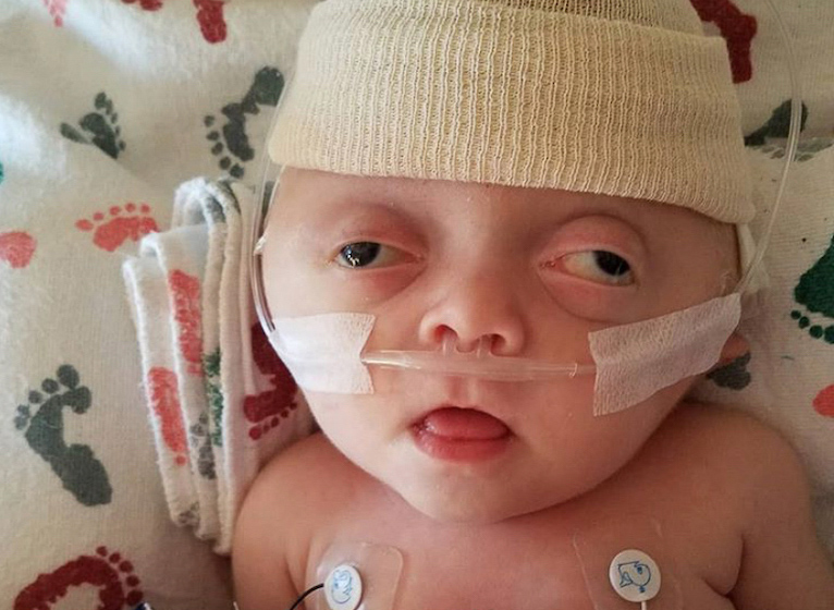 Doctors removed her baby’s skull, then a ‘true miracle happened’!