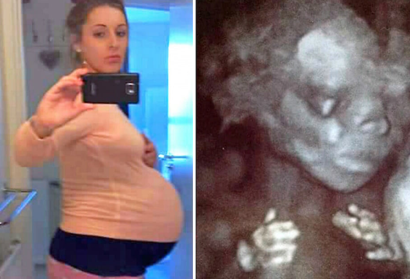 Surrogate mom carried couple’s child, ‘then they look closer at the scan and froze’!