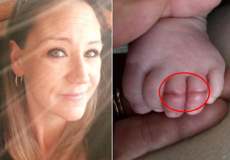 Mom spotted strange mark on her baby’s toes, ‘she knew she had to warn other parents after her baby almost had them amputated’!